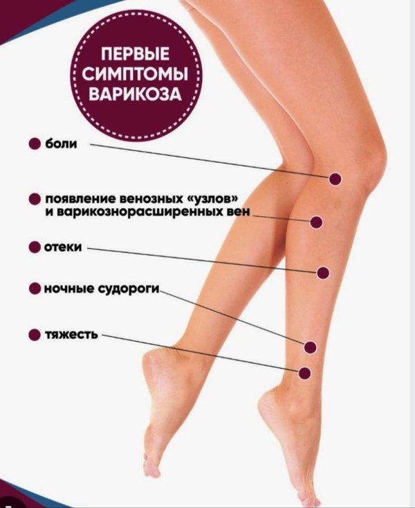 Лечение трофических язв в Морозовске, запись, цены ООО Здоровье