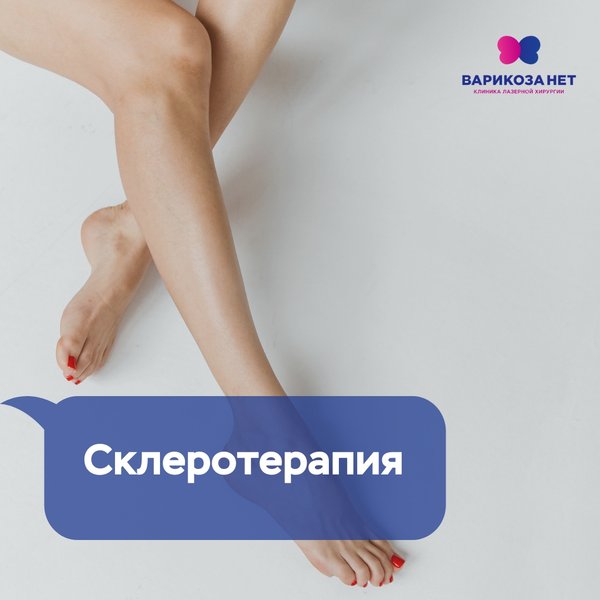 Варикоза нет чебоксары. Варикоза нет чебоксары