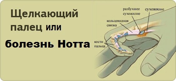 Травматическая ампутация ногтевой пластины карта вызова