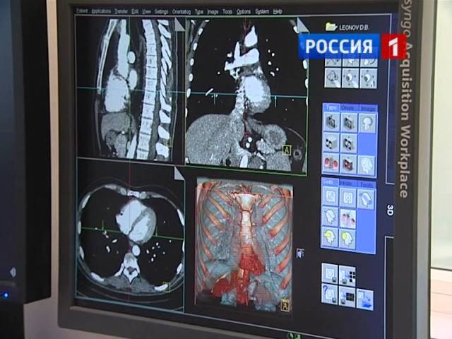 Кт сосудов почки с контрастированием. Нативная мскт. Нативная мскт. Кт почек с контрастированием кт. Мскт с контрастированием.