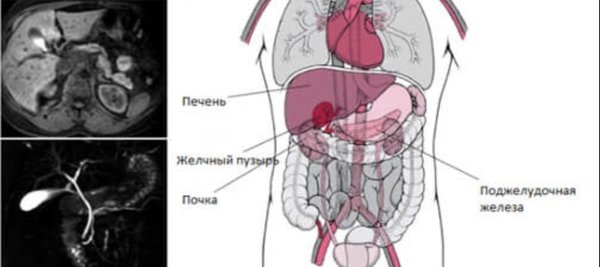 Опущение внутренних органов фото