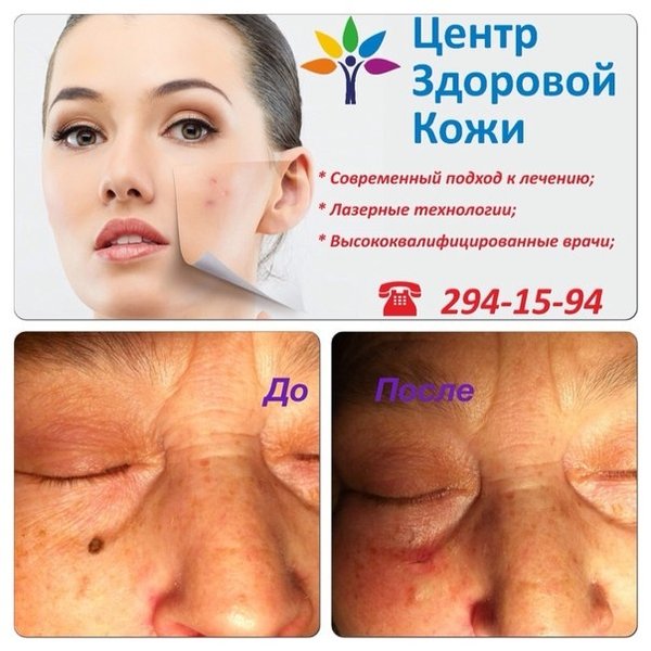 центр здоровой кожи уфа. эрудита клиника уфа. уфа ул революционная 70 центр здоровой кожи. центр здоровой кожи уфа. уфа.